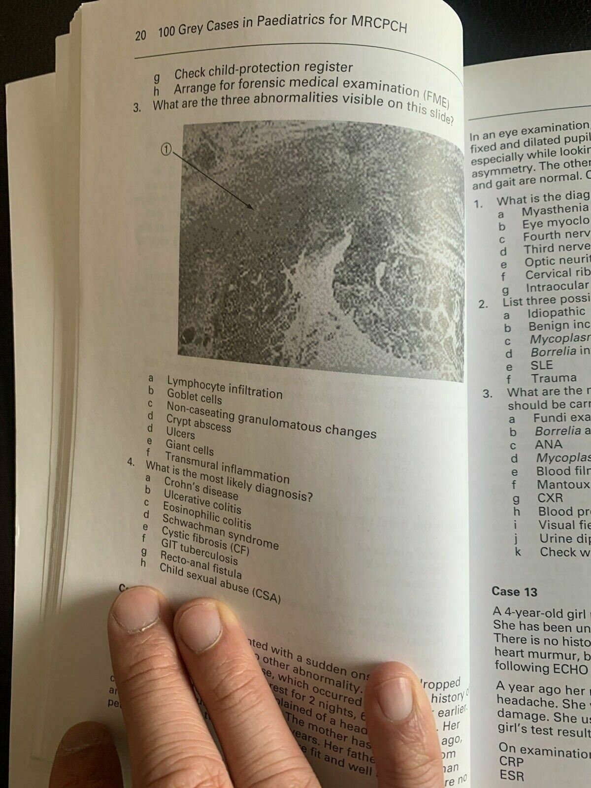 100 Grey Cases in Paediatrics for MRCPCH By Nagi G Barakat