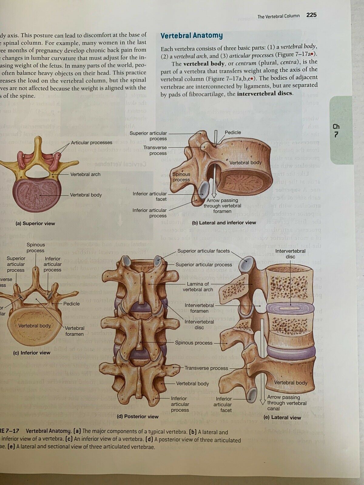 Fundamentals Of Anatomy & Physiology By Frederic H Martini 7th Edition