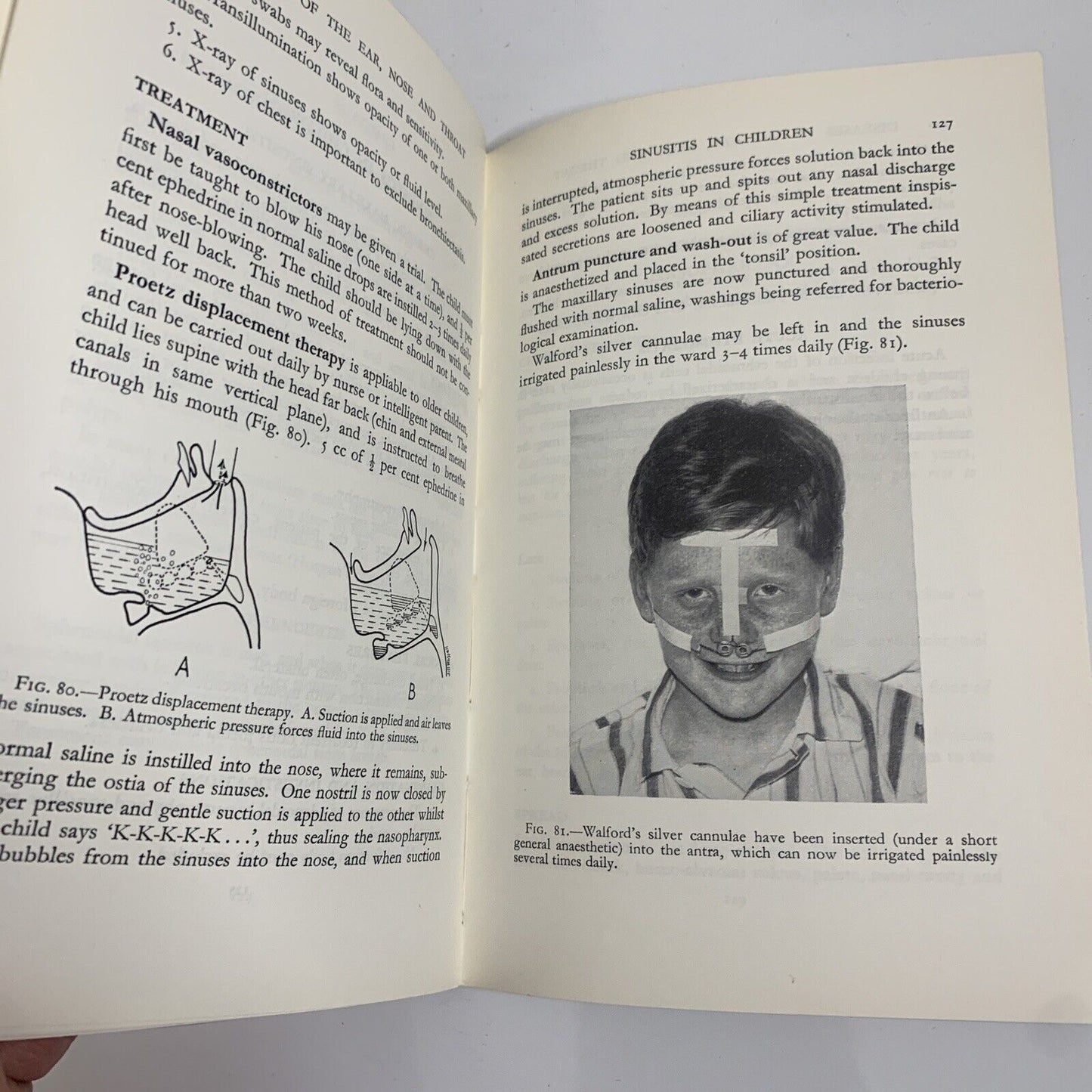 Lecture Notes On Diseases Of The Ear Nose and Throat by E H Miles Foxen