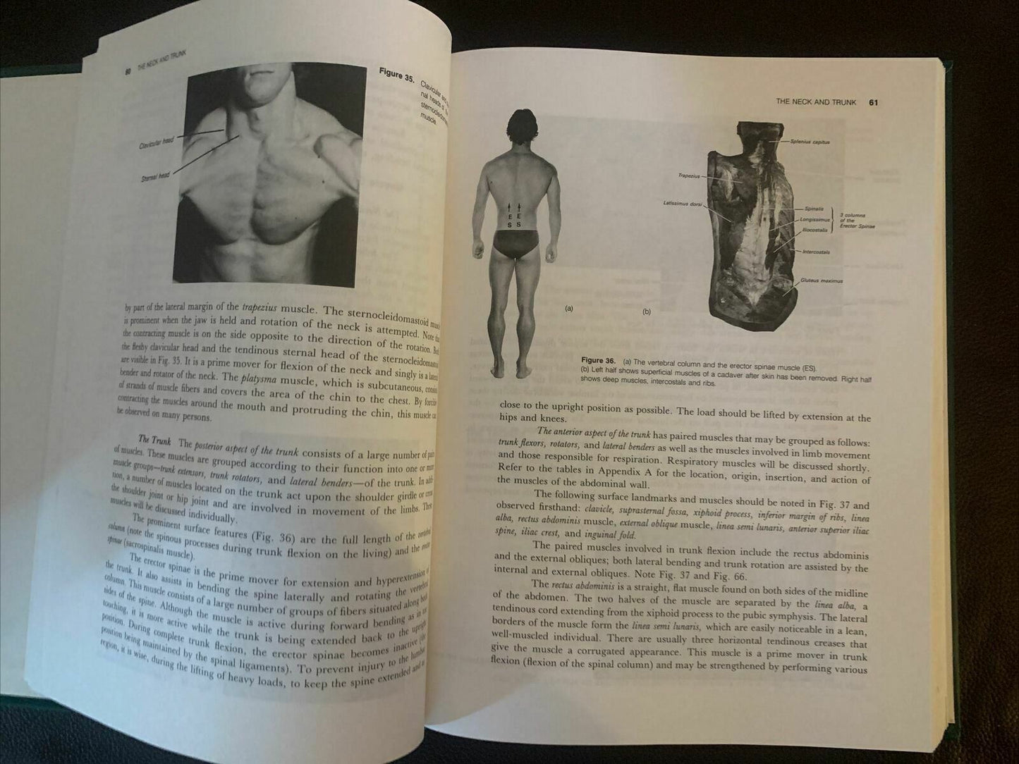 Anatomy, Mechanics, and Human Motion (2nd Edition) by James G. Hay, J. Garvin R