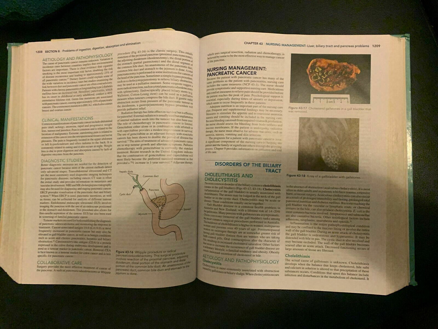 Lewis's Medical-surgical Nursing: Assessment and Management of Clinical Problems