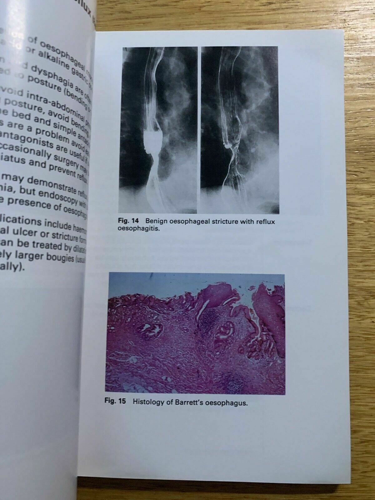 Gastroenterology And Liver Disease - Colour Aids by G. Holdstock, R. Wright