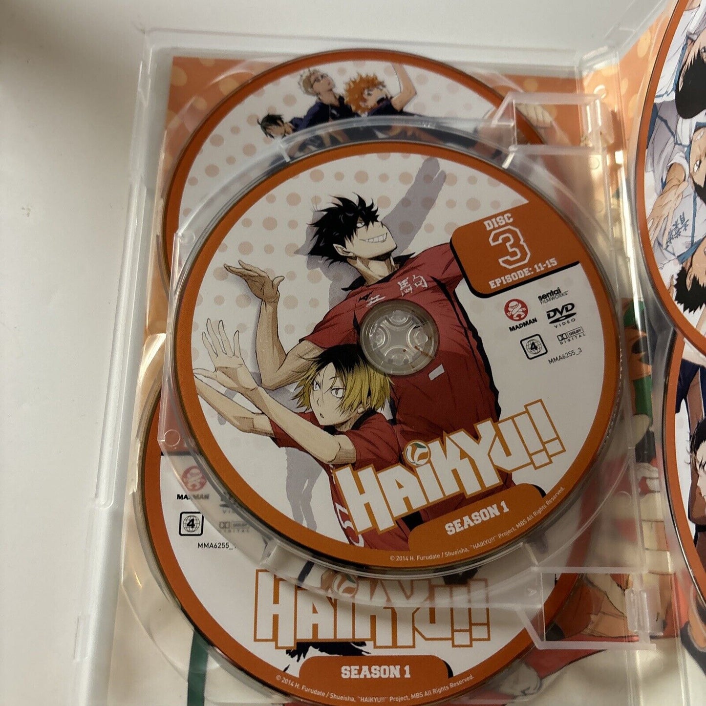 Haikyu!! : Season 1 (DVD, 2014, 5-Disc) Region 4