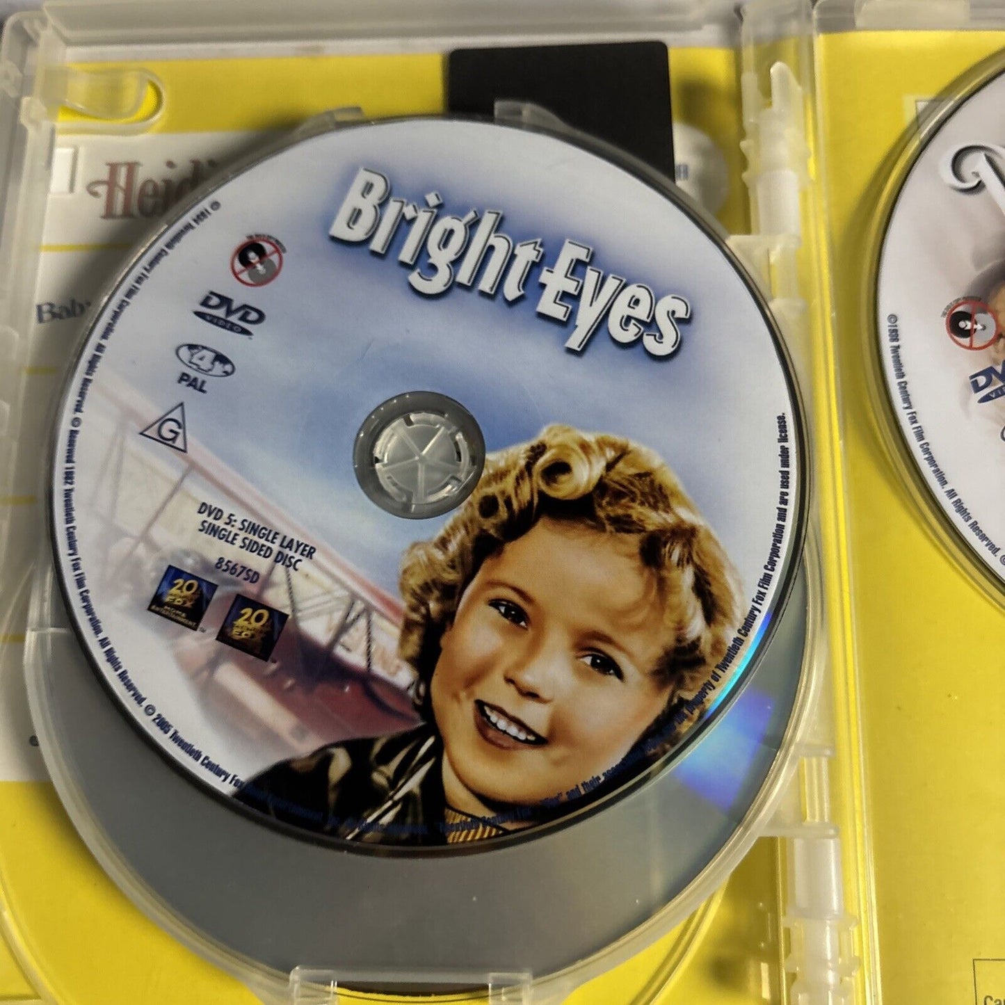 Shirley Temple: Heidi, Baby Take A Bow, Bright Eye, Captain January, Dimples DVD