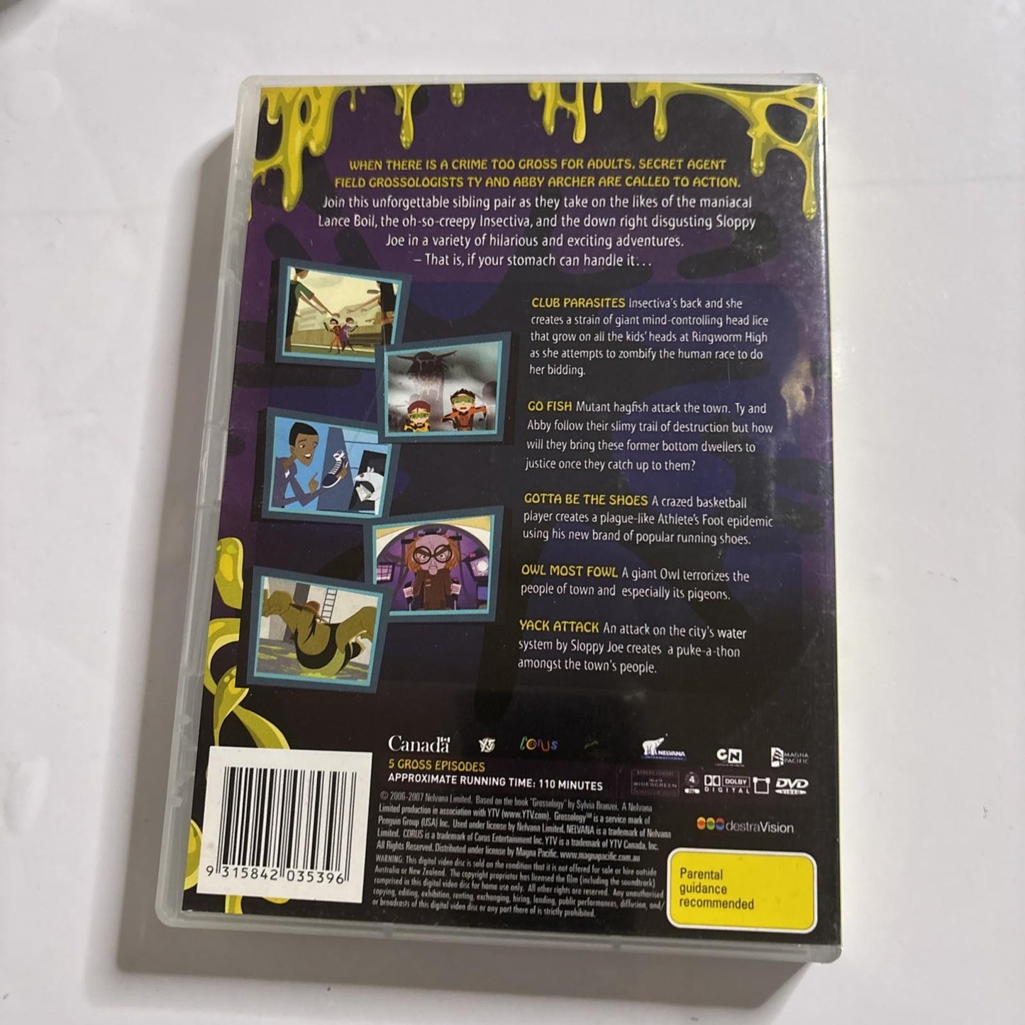 Grossology: Yack Attack : Vol 2 (DVD, 2006) Region 4