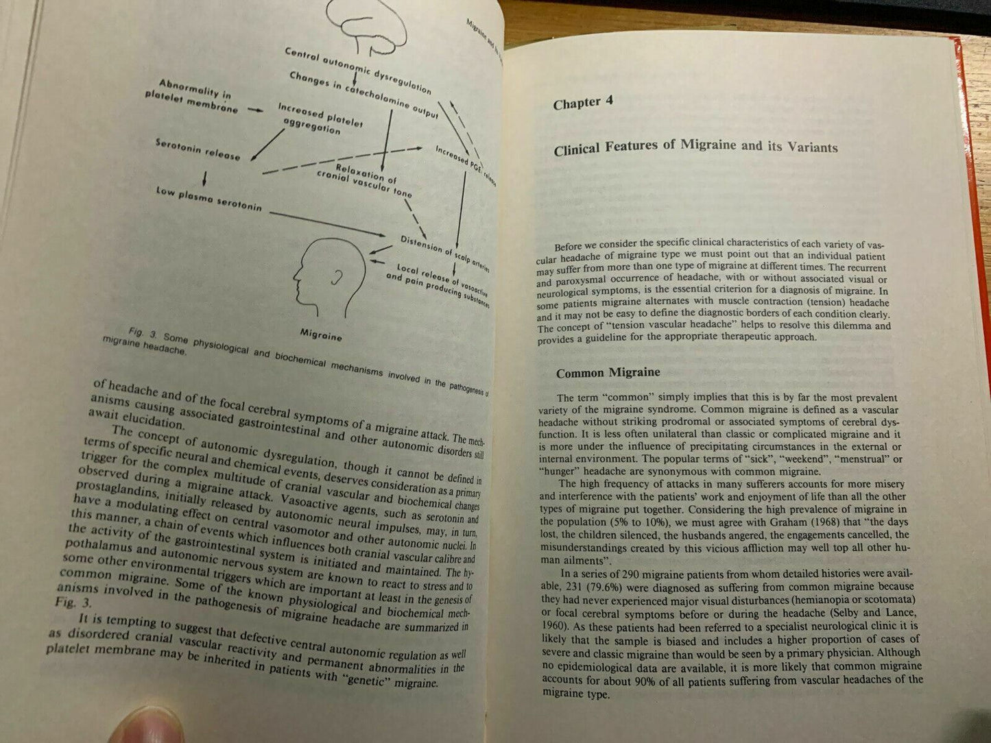 Migraine and Its Variants by George Selby (Paperback, 1983)