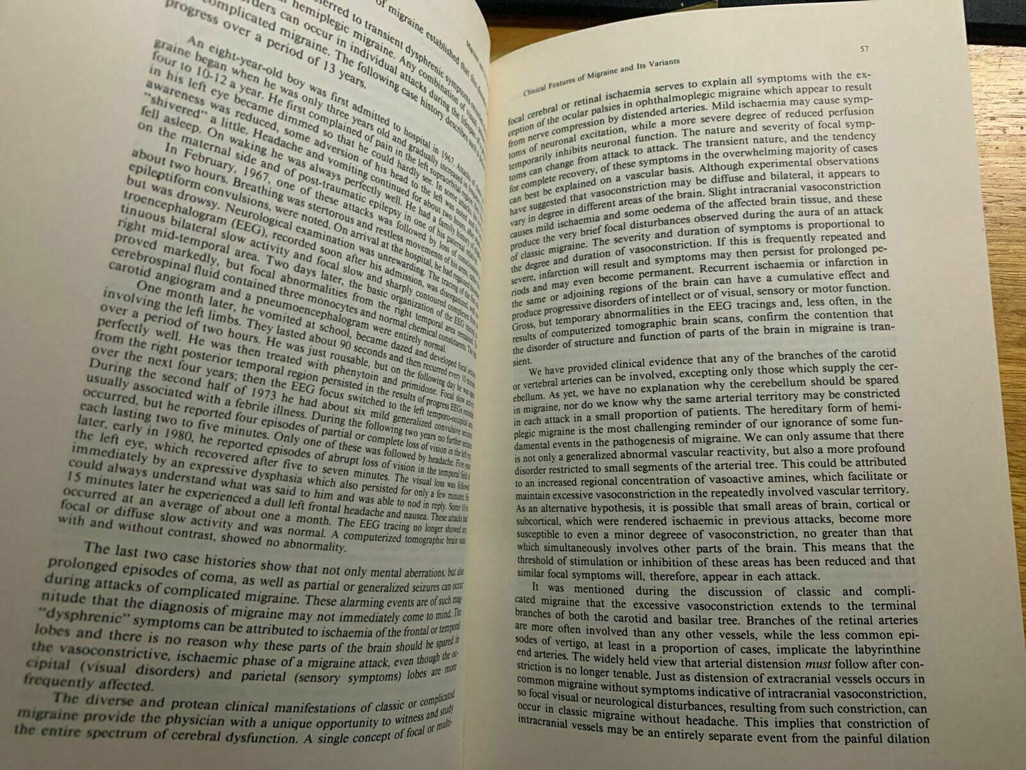 Migraine and Its Variants by George Selby (Paperback, 1983)