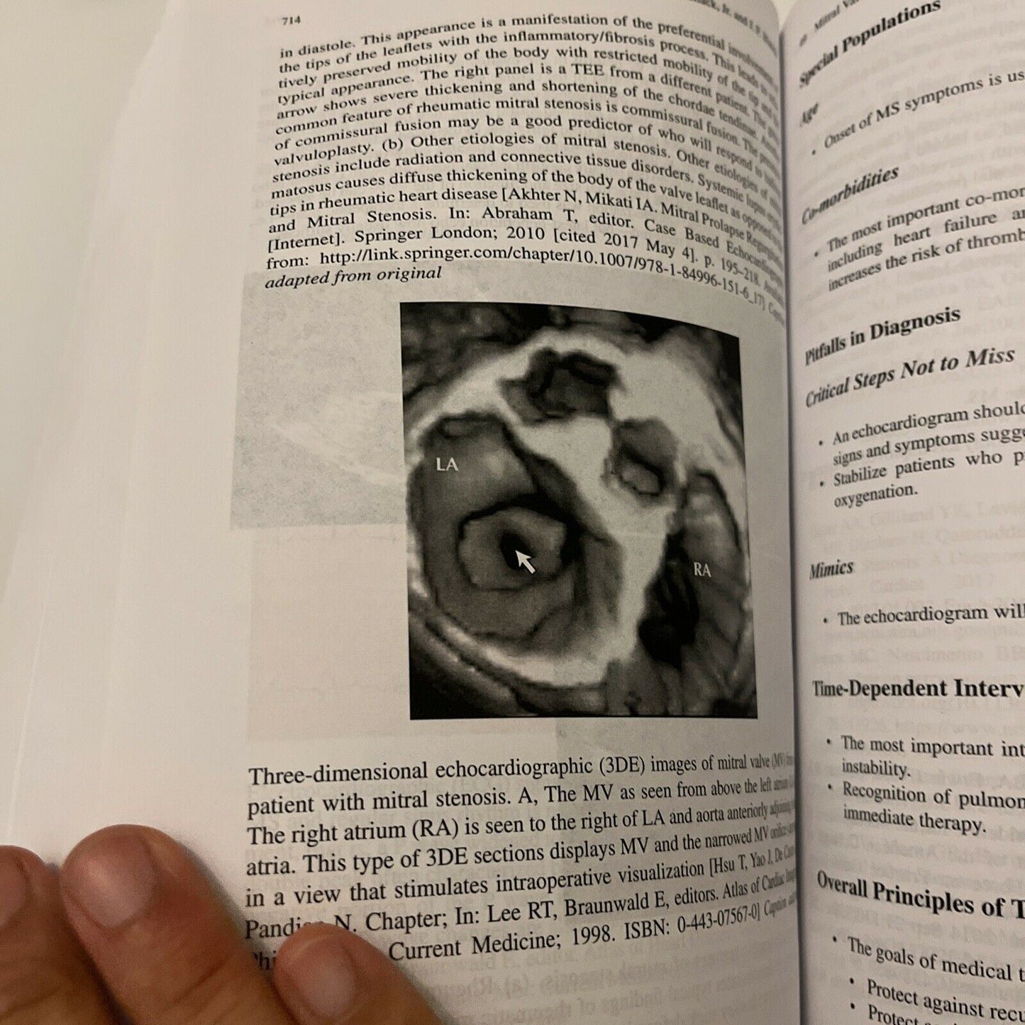 Differential Diagnosis of Cardiopulmonary Disease: A Handbook by C. Pollack 2019