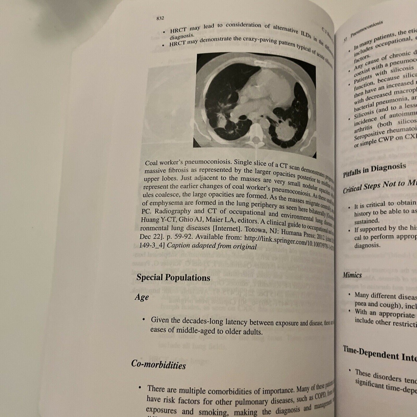 Differential Diagnosis of Cardiopulmonary Disease: A Handbook by C. Pollack 2019