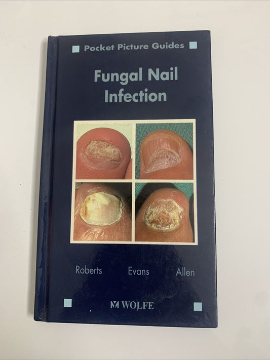 Fungal Nail Infection Pocket Picture Guide by D T Roberts, E G V Evans, B Allen