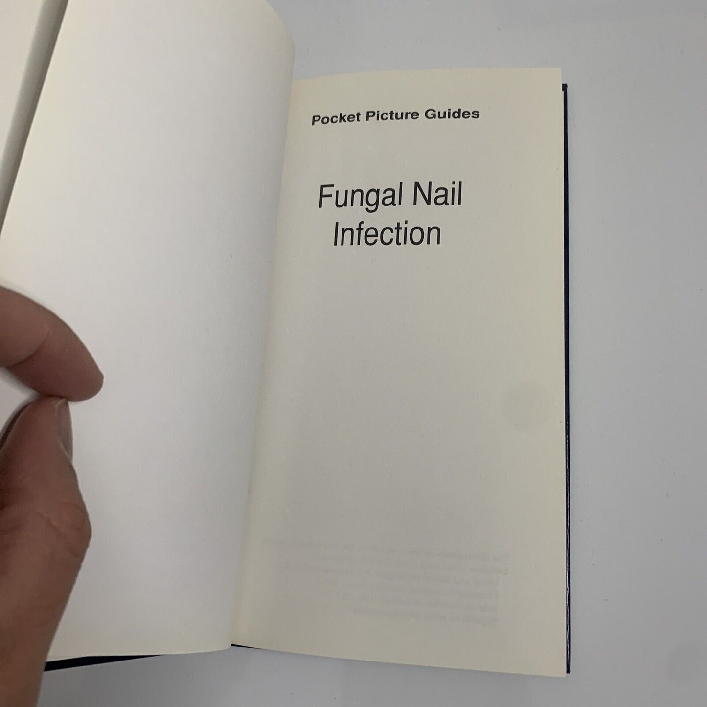 Fungal Nail Infection Pocket Picture Guide by D T Roberts, E G V Evans, B Allen