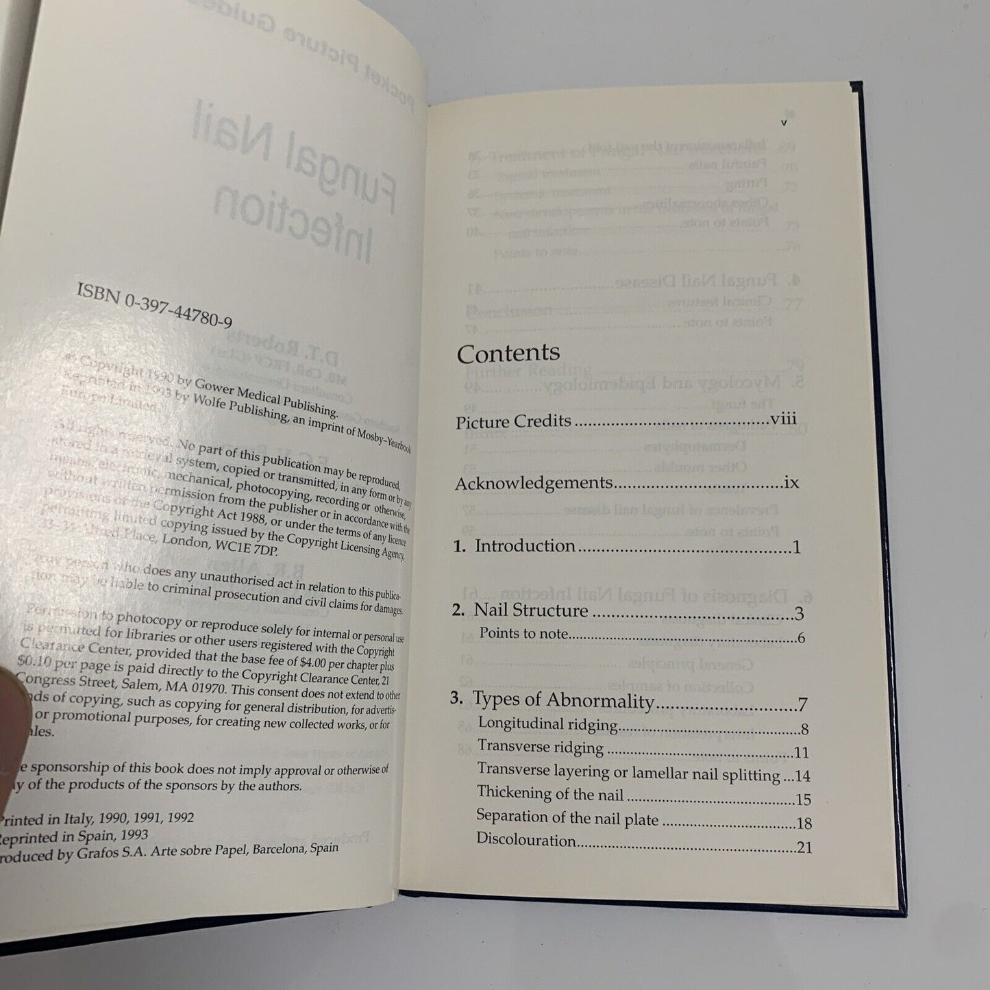 Fungal Nail Infection Pocket Picture Guide by D T Roberts, E G V Evans, B Allen