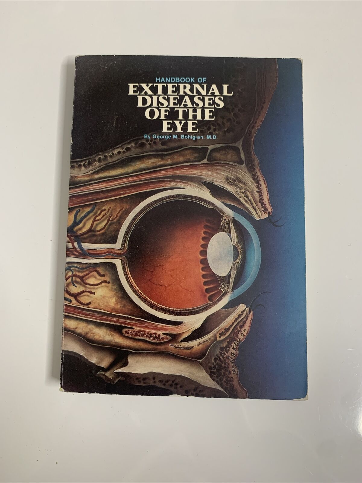 Handbook Of External Diseases of the Eye by George M Bohigian